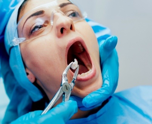 Dentist performing tooth extraction