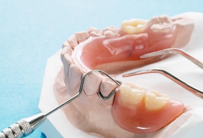 partial dentures on a plaster mold