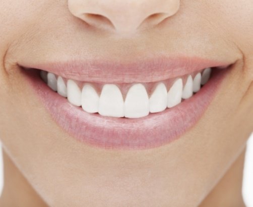 Closeup of smile after gum recontouring