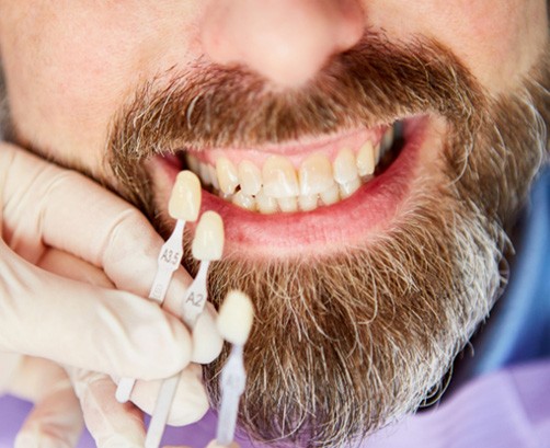 a cosmetic dentist holding a shade chart up to a patient’s teeth