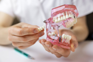 Dentist holding a dental implant model in one hand and a bridge restoration in the other hand